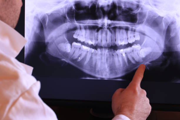 Best Emergency Gum Pain Relief  in Glenmoor, OH