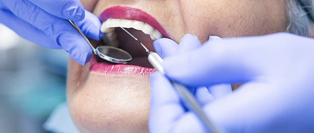 Best Chipped Tooth Repair Near Me  in Glenmoor, OH